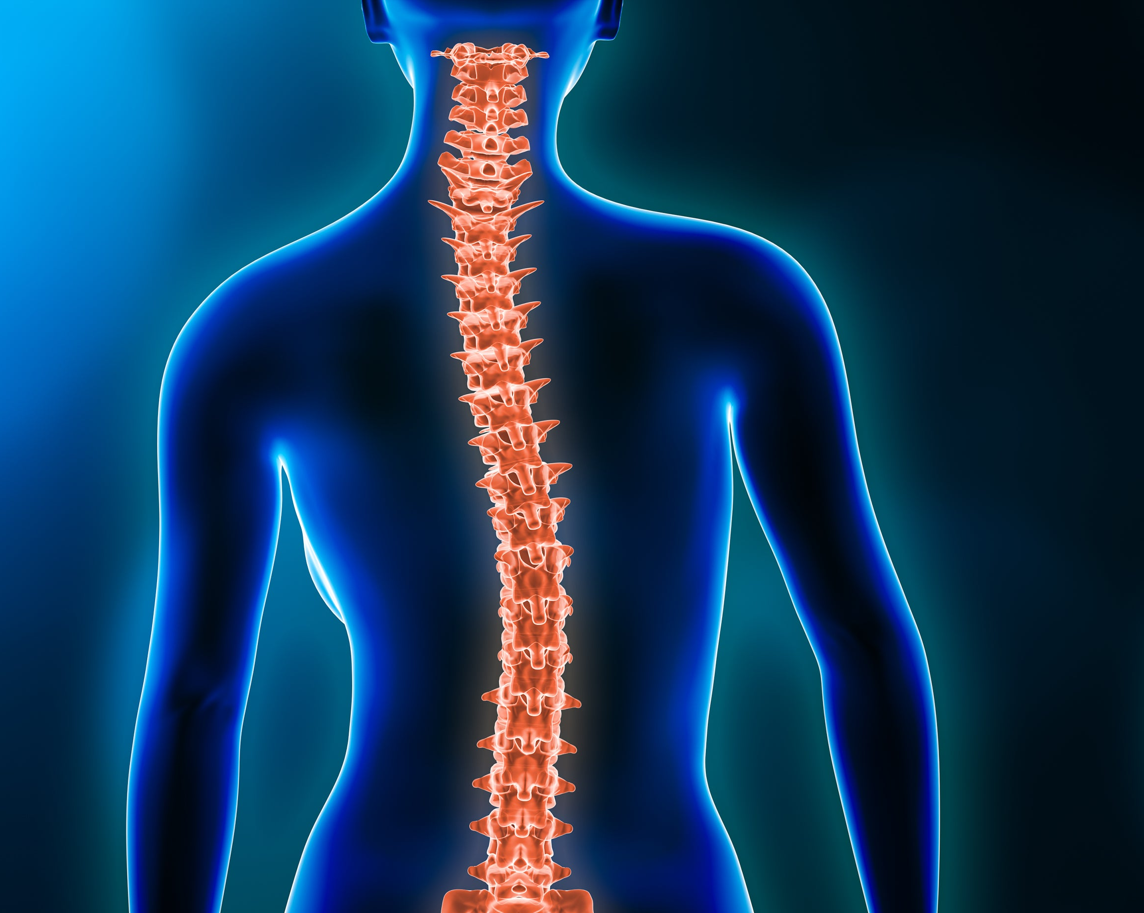 Stages of Lumbar Spinal Stenosis: Mild, Moderate & Severe Explained